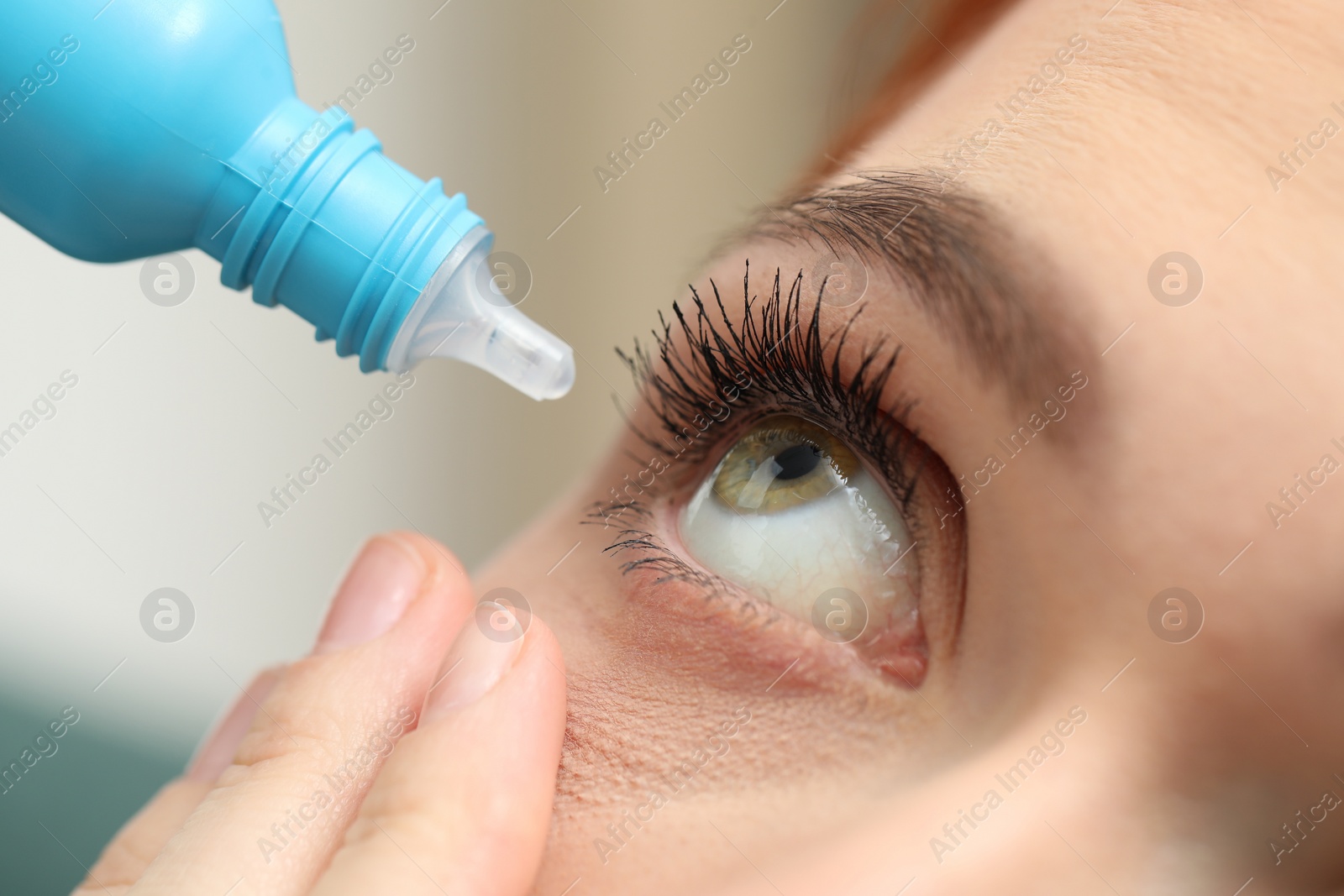 Photo of Woman applying medical eye drops, macro view