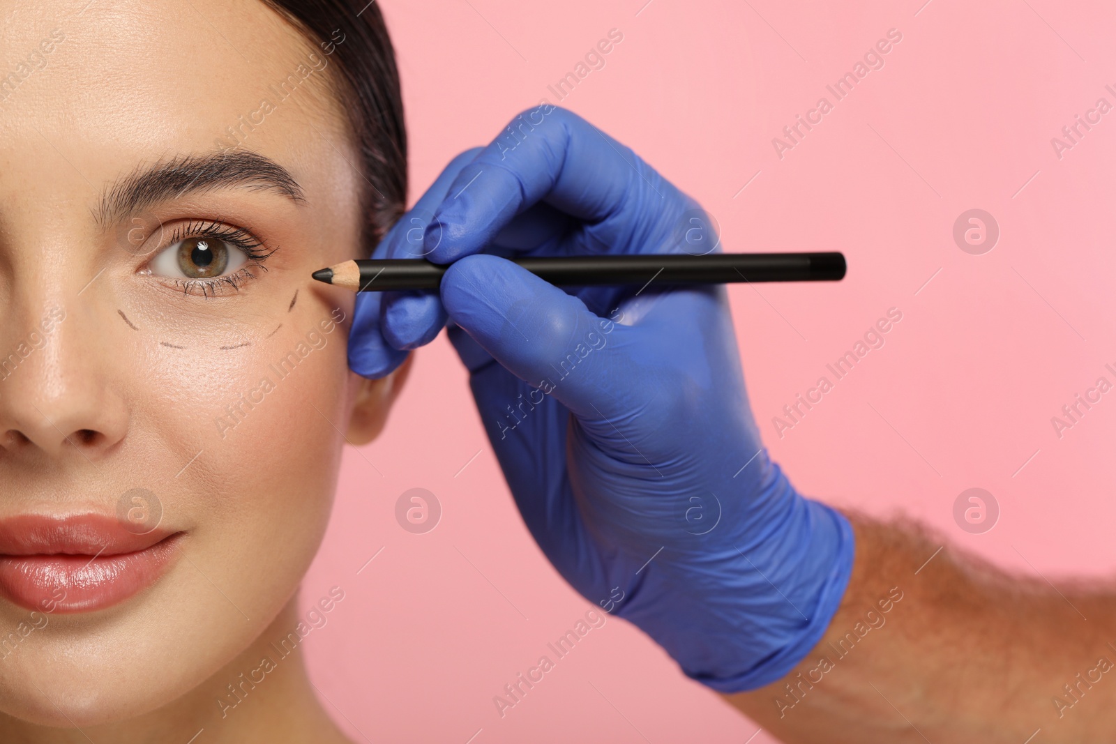 Photo of Doctor with pencil preparing patient for cosmetic surgery operation on pink background, closeup