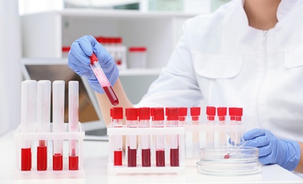 Photo of Scientist working with blood samples in test tubes at table