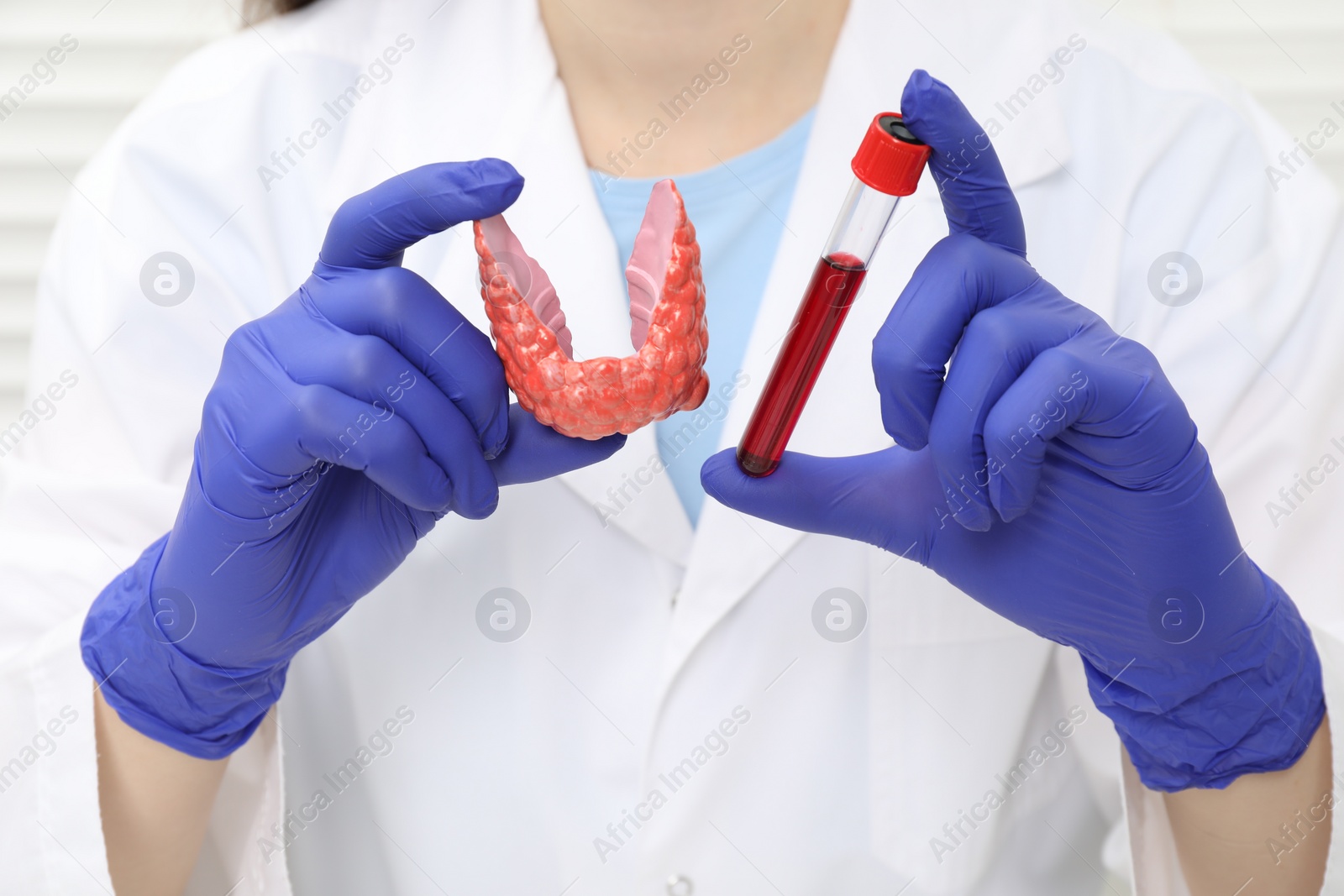 Photo of Endocrinologist showing thyroid gland model and blood sample in test tube, closeup