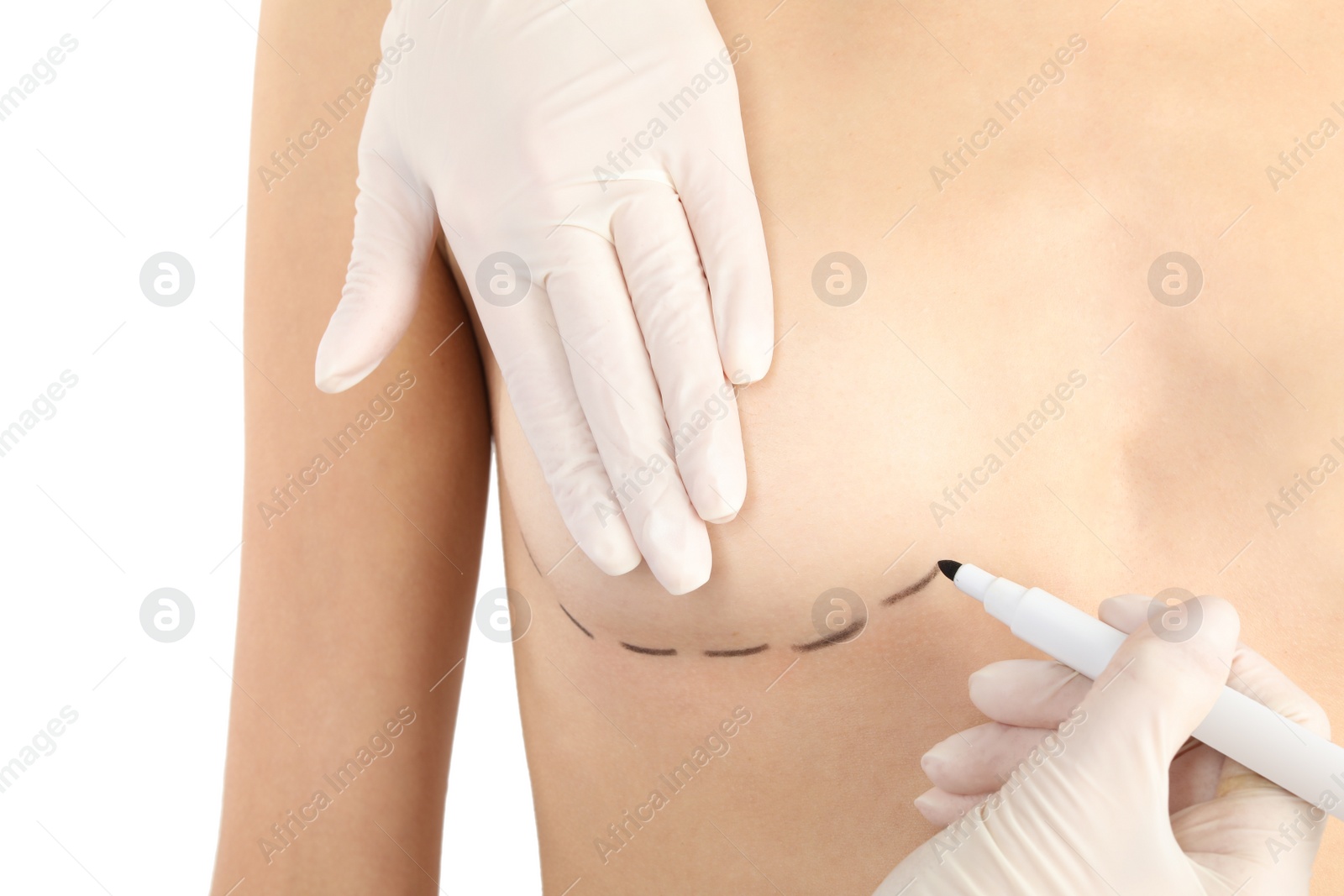 Photo of Doctor drawing marks on patient's breast for cosmetic surgery operation against white background, closeup