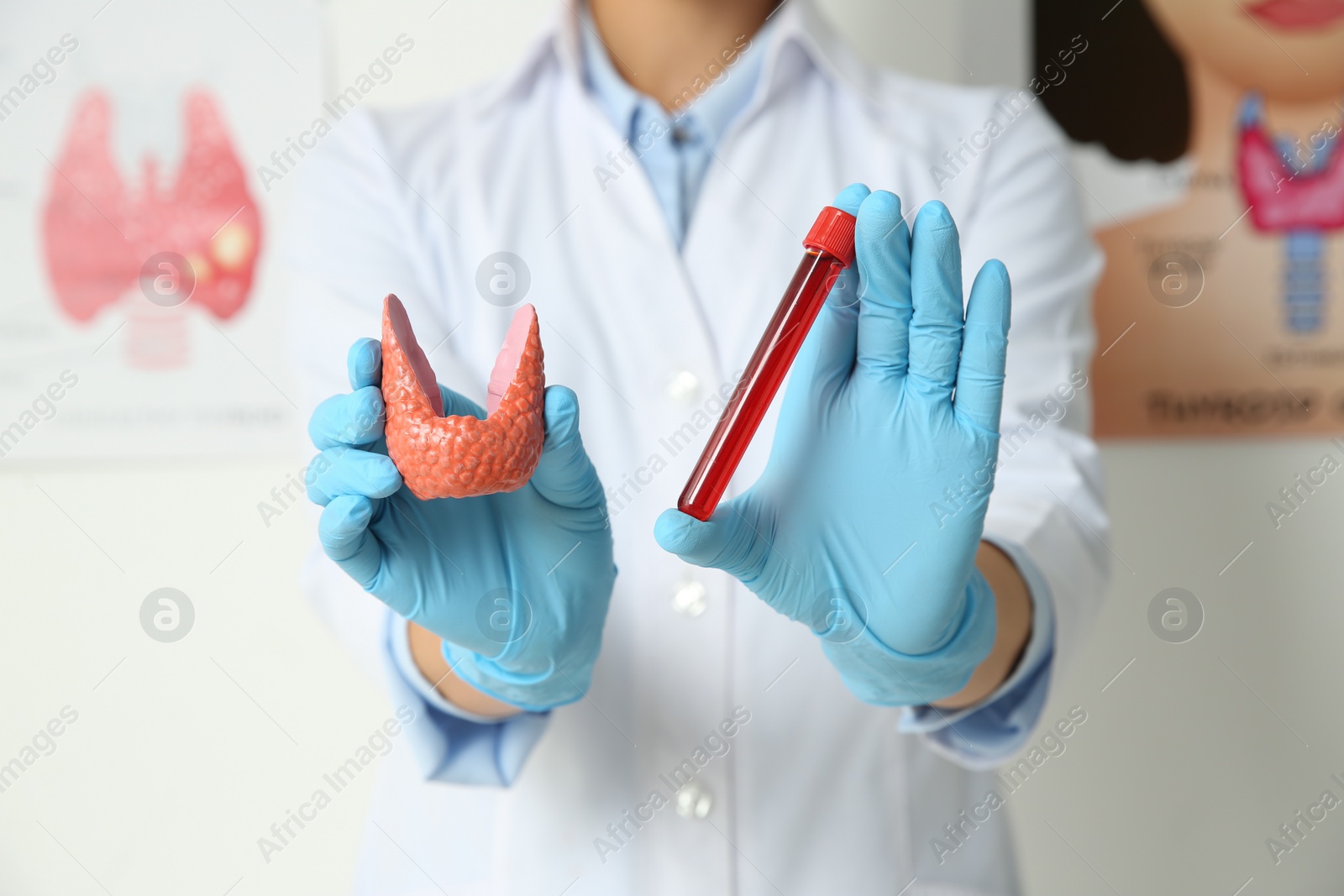 Photo of Endocrinologist showing thyroid gland model and blood sample in hospital, closeup