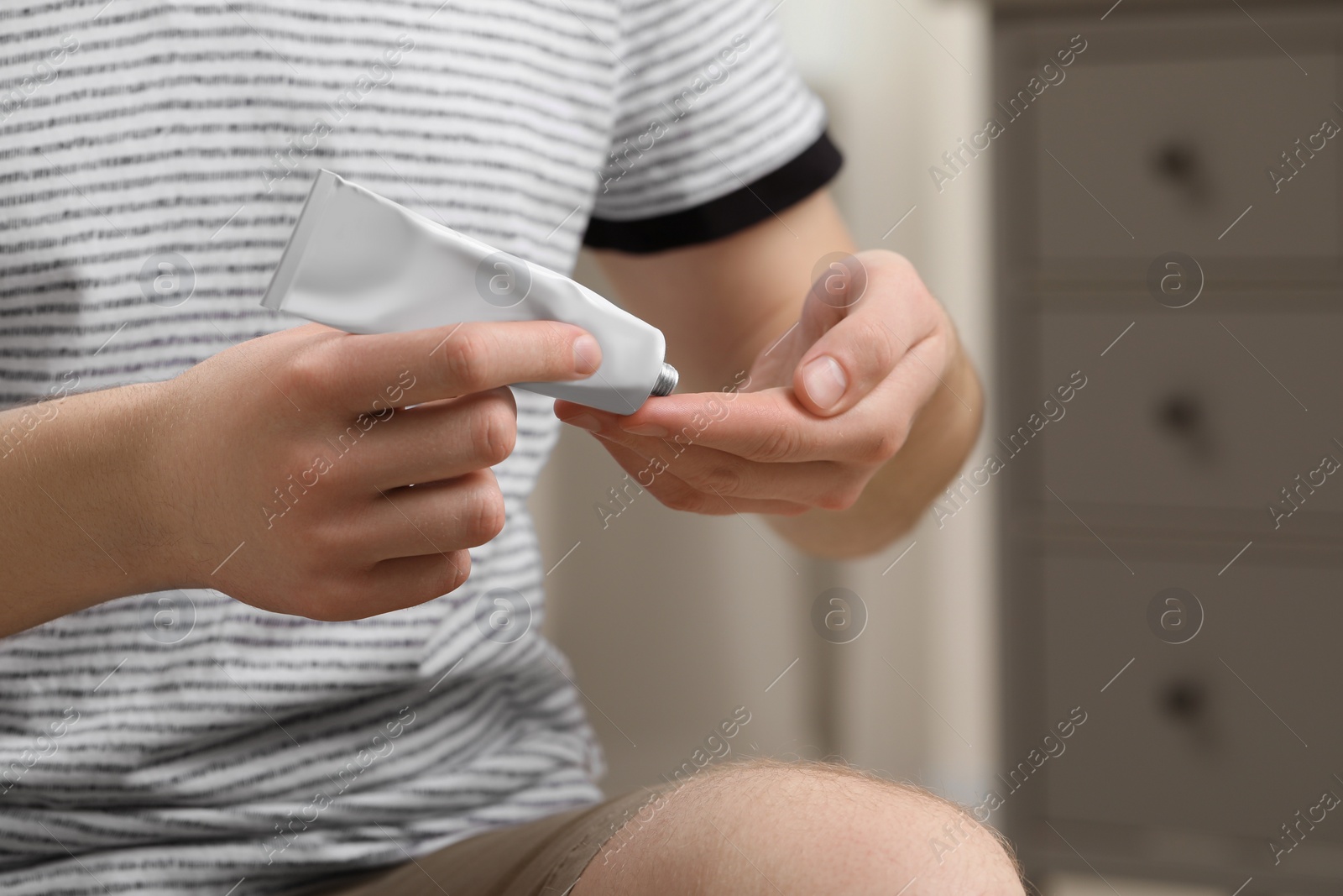 Photo of Man applying ointment from tube onto his fingers indoors, closeup