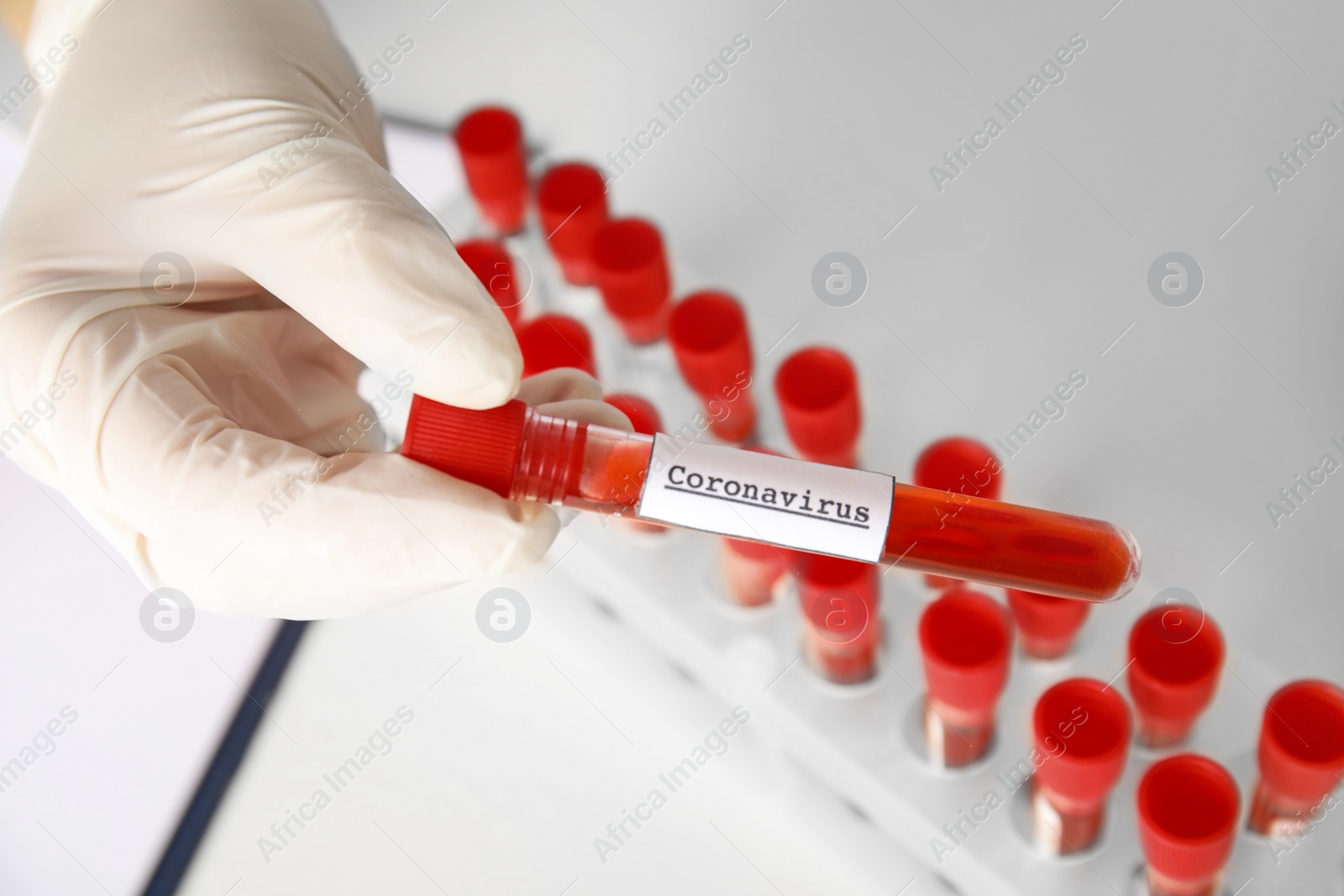 Photo of Scientist holding test tube with blood sample and label CORONA VIRUS in laboratory, above view