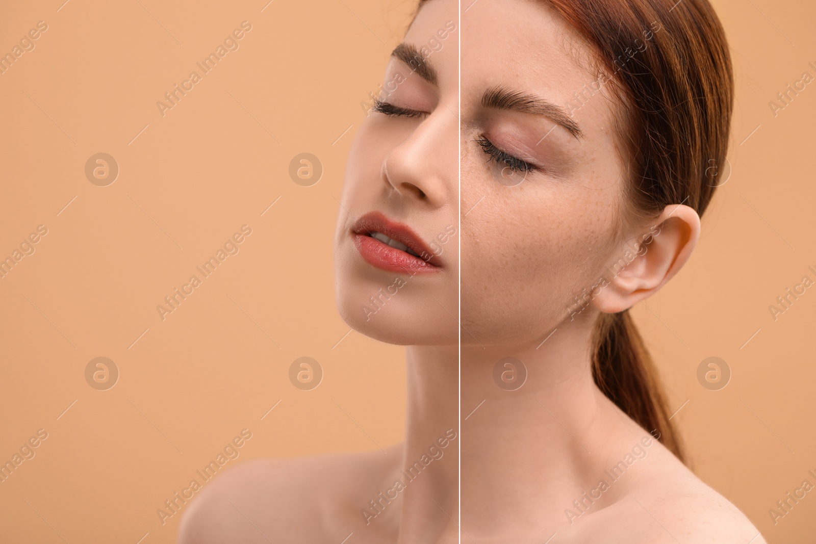 Image of Woman with freckles and clear skin on dark beige background, collage