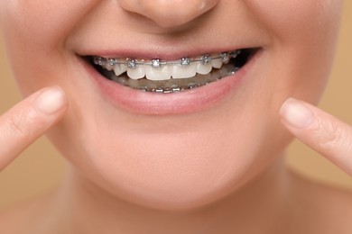 Photo of Smiling woman showing braces on her teeth against brown background, closeup