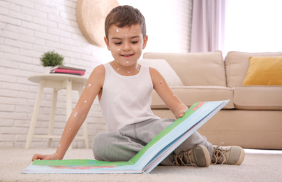 Little boy with chickenpox reading book at home