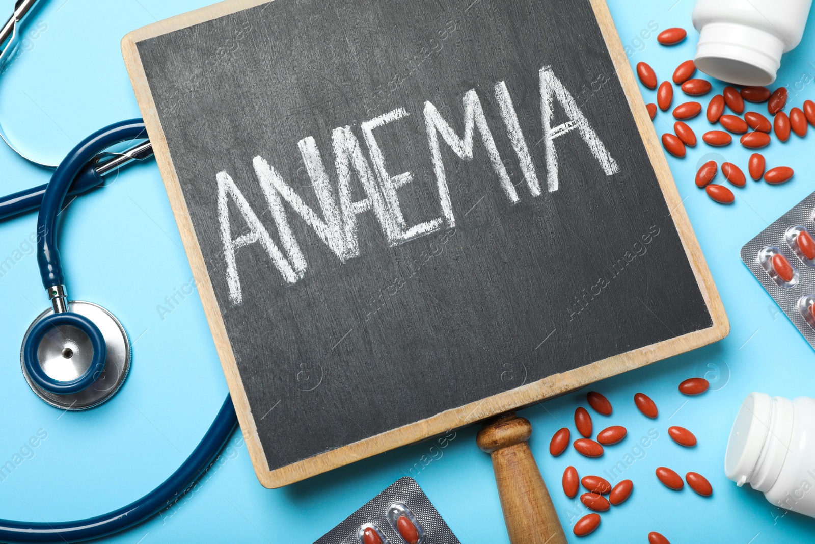 Photo of Small blackboard with word Anaemia, pills and stethoscope on light blue background, flat lay