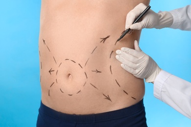 Photo of Doctor drawing marks on man's body for cosmetic surgery operation against blue background, closeup