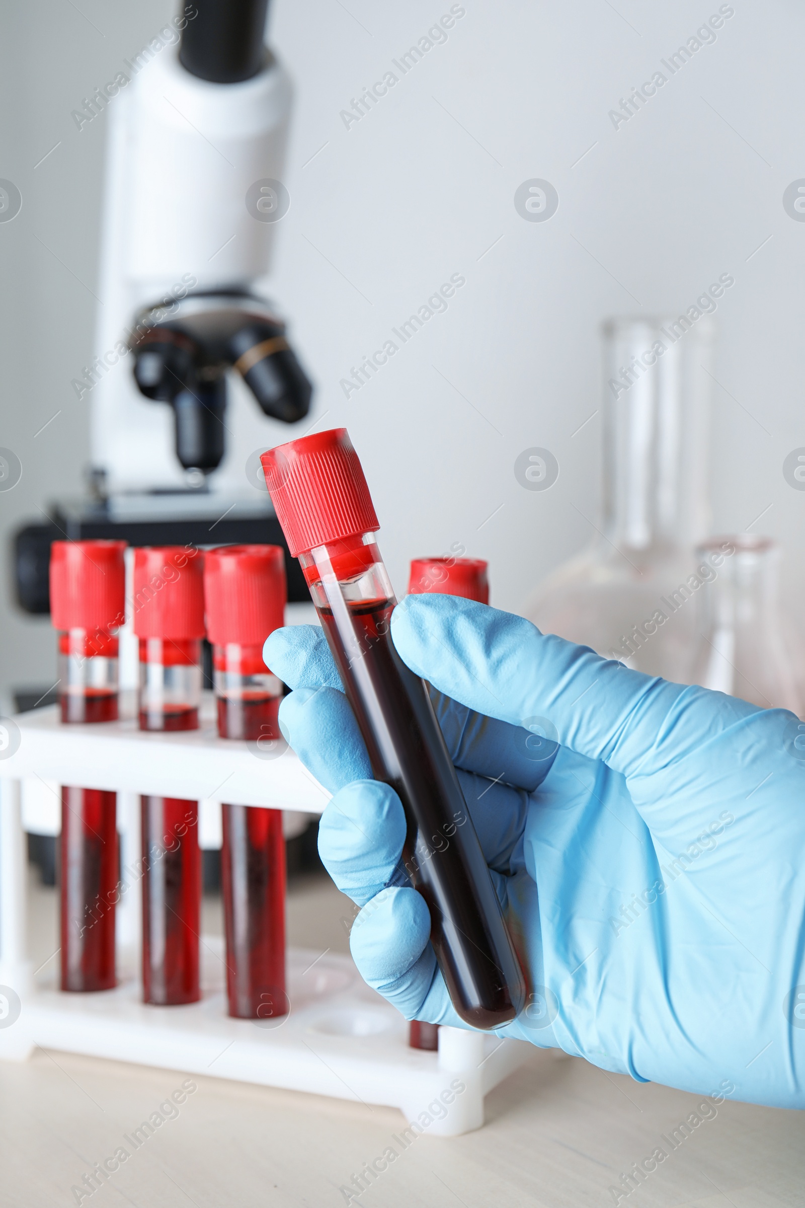 Image of Scientist holding test tube with blood sample near microscope, closeup. Laboratory analysis