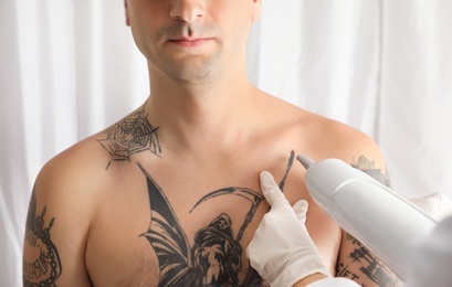 Photo of Man undergoing laser tattoo removal procedure in salon