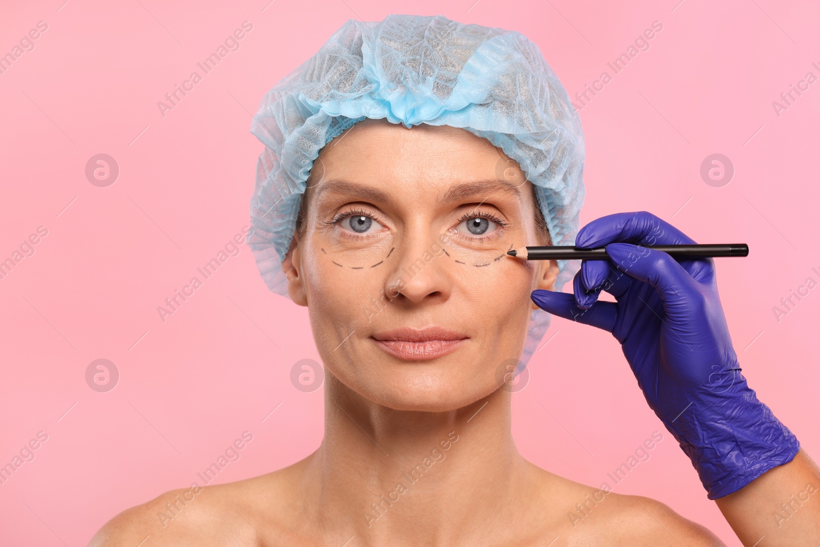 Photo of Doctor with pencil preparing patient for cosmetic surgery operation on pink background