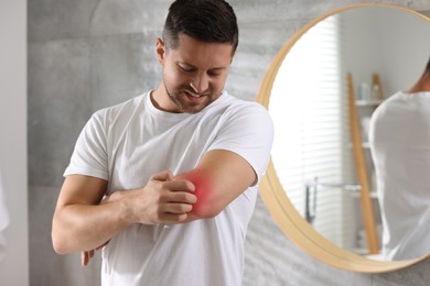 Man suffering from allergy scratching his arm indoors