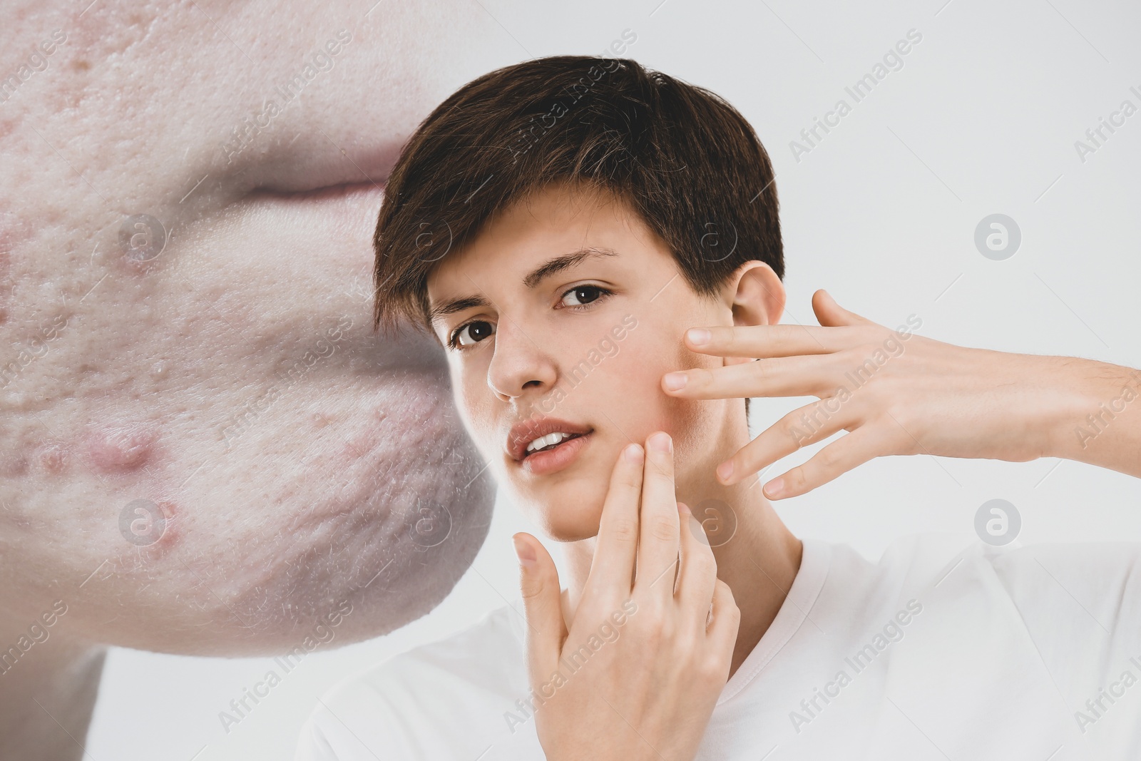 Image of Teenage boy suffering from acnephobia examining face. Vision of person with problem skin