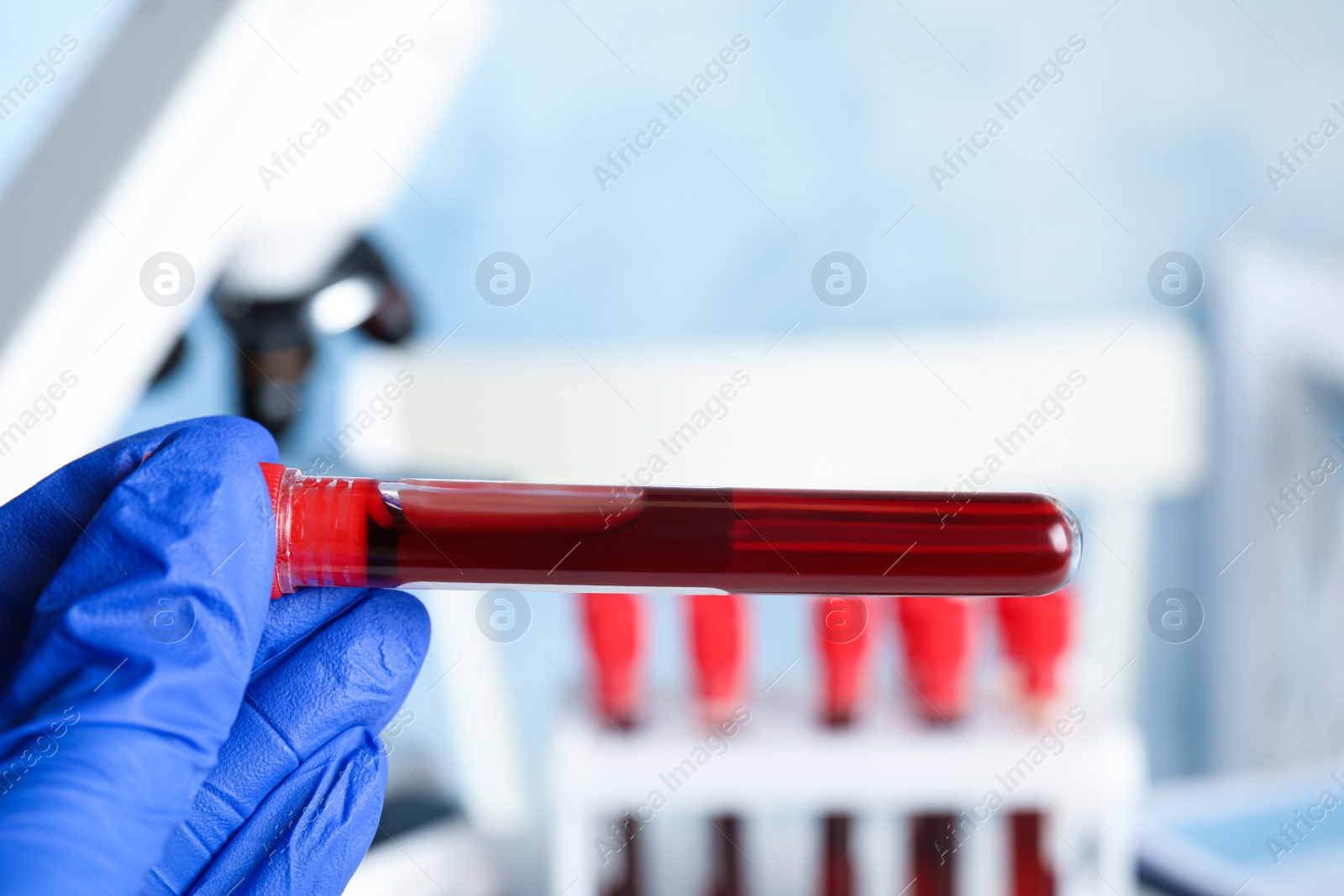 Photo of Scientist holding test tube with blood sample at table, closeup. Virus research