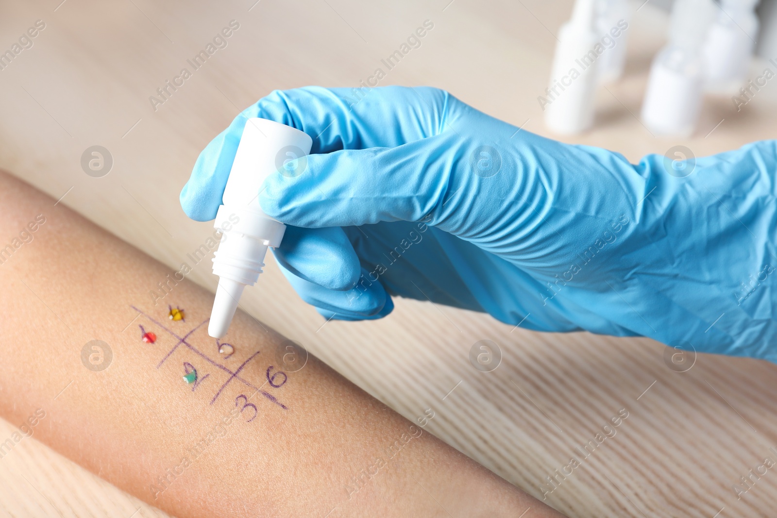 Photo of Doctor making allergy test at table, closeup