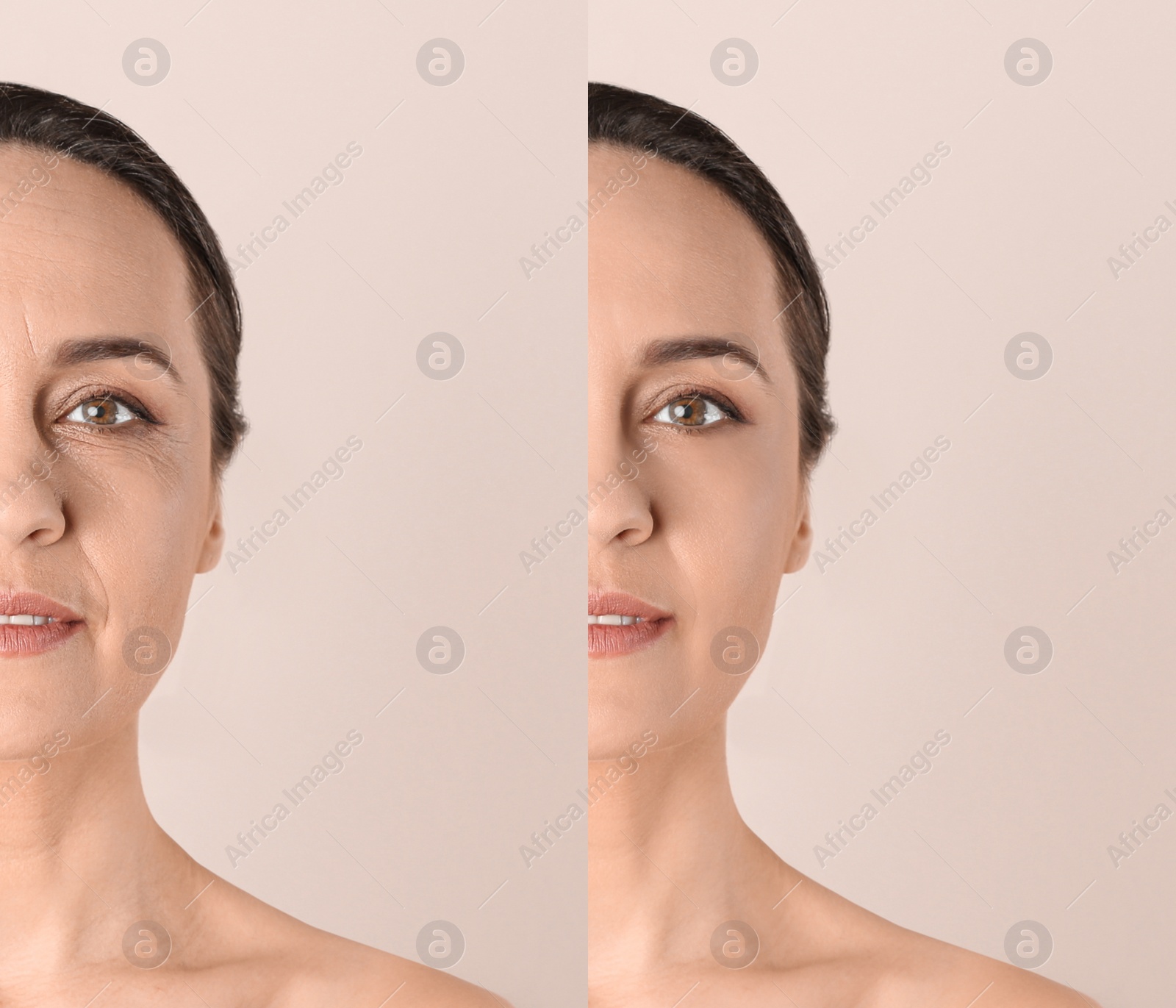 Image of Mature woman before and after cosmetic procedure on beige background 