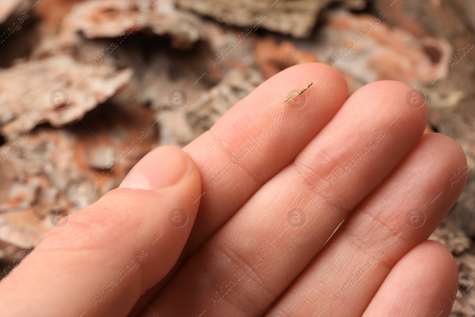 Photo of Woman with splinter in her finger on blurred background, closeup