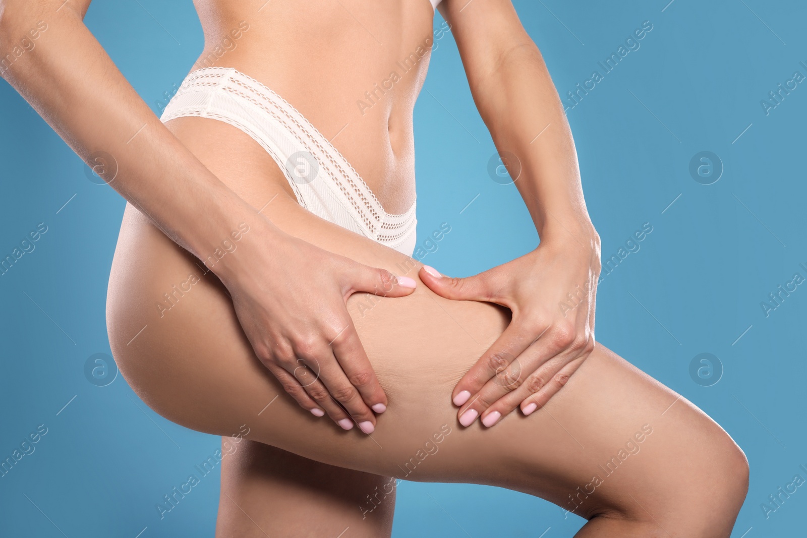 Photo of Closeup view of slim woman in underwear on light blue background. Cellulite problem concept