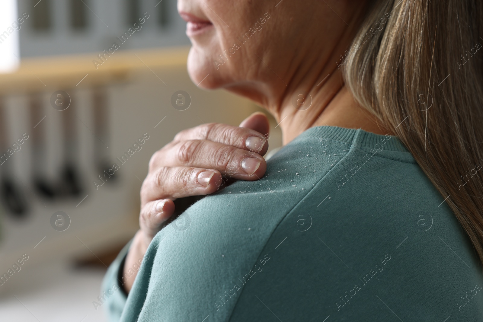 Photo of Woman brushing dandruff off her sweater indoors, closeup