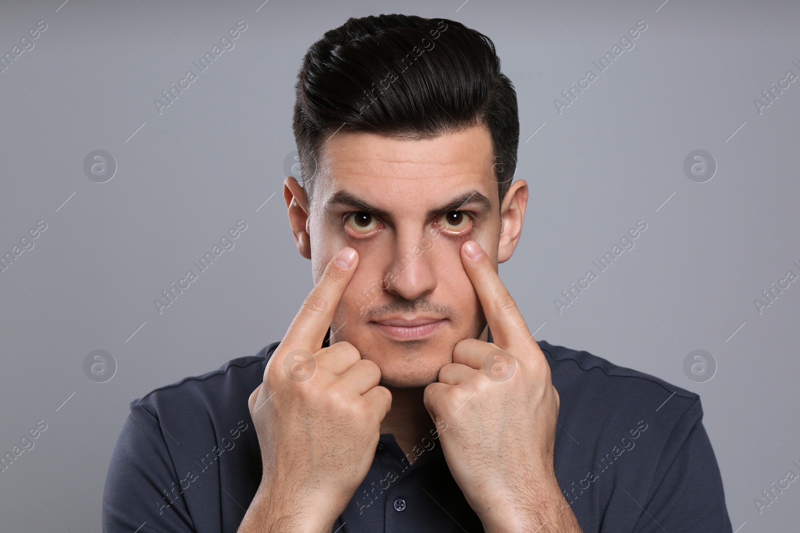 Photo of Man checking his health condition on grey background. Yellow eyes as symptom of problems with liver