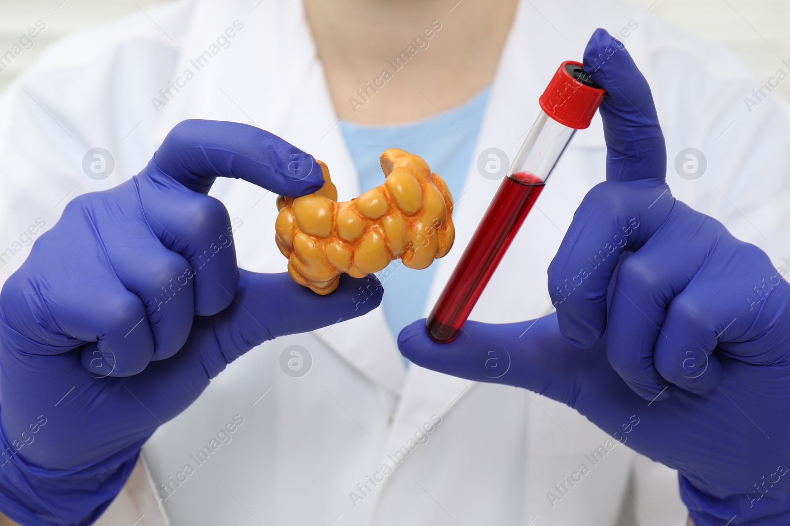 Photo of Endocrinologist showing thyroid gland model and blood sample in test tube, closeup