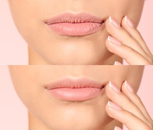 Collage with photos of woman before and after using lip balm on pink background, closeup