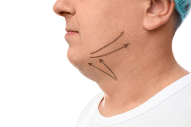 Photo of Mature man with marks on face against white background, closeup. Double chin removal