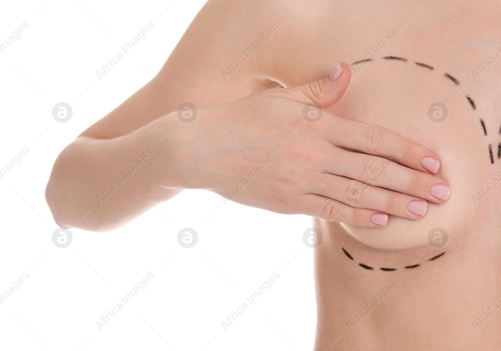 Photo of Young woman with marks on breast for cosmetic surgery operation against white background