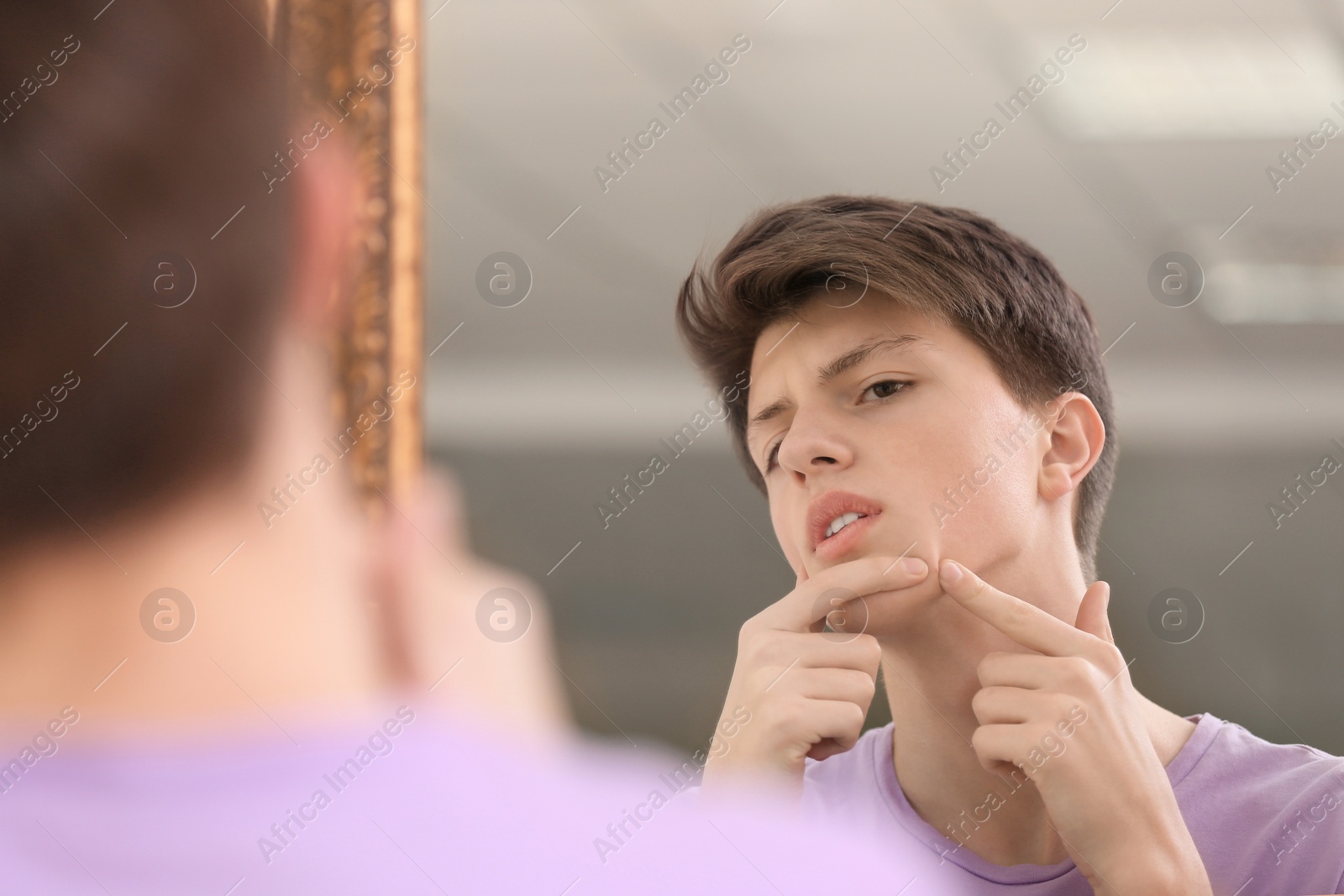 Photo of Teenage boy with acne problem looking in mirror at home