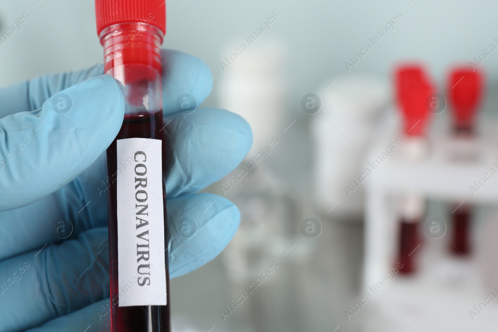 Photo of Doctor holding test tube with blood sample and label CORONAVIRUS in laboratory, closeup of hand