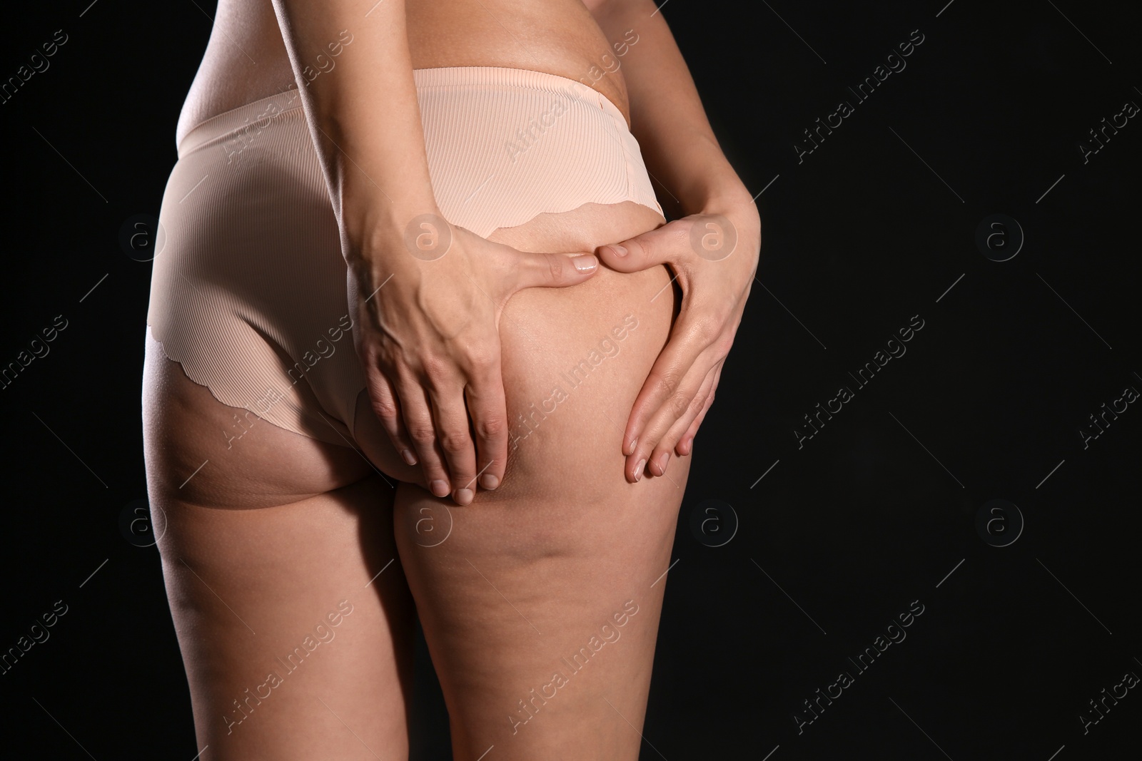 Photo of Woman with cellulite on black background, closeup