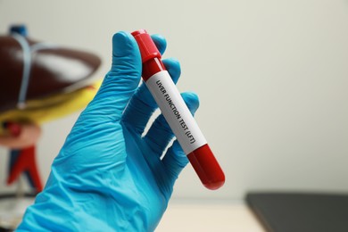 Laboratory worker holding tube with blood sample and label Liver Function Test on blurred background, closeup