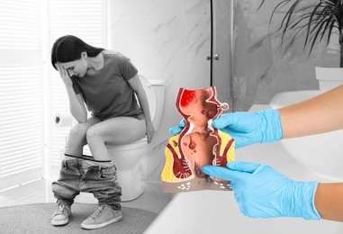 Proctologist holding anatomical model of rectum, closeup. Woman suffering from hemorrhoid on toilet bowl in rest room
