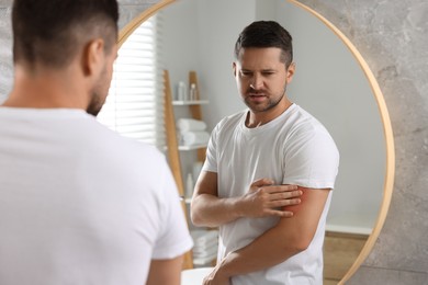 Photo of Man suffering from allergy looking at his arm in mirror indoors