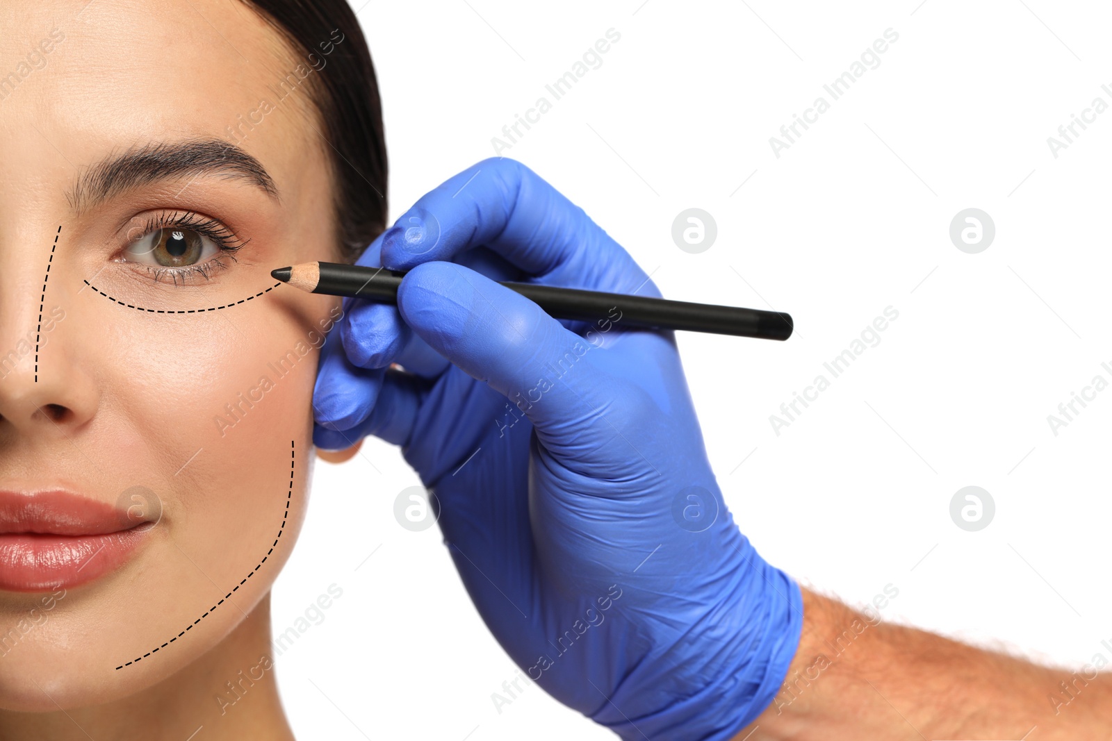 Image of Woman preparing for cosmetic surgery, white background. Doctor drawing markings on her face, closeup