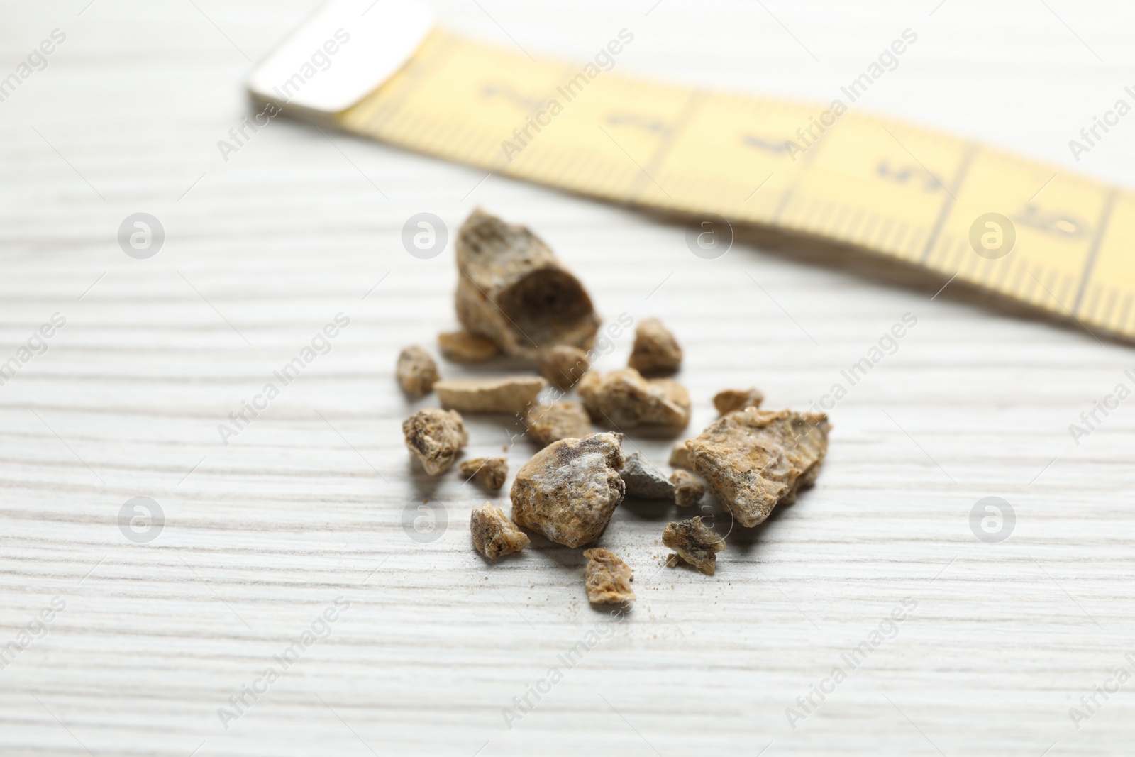 Photo of Kidney stones and measuring tape on white wooden table, closeup