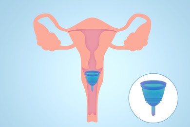Illustration of Instruction how to use menstrual cup during period. Female reproductive system on light blue background, illustration