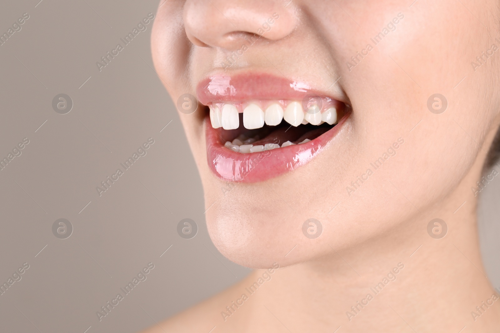 Image of Woman with diastema between upper front teeth on light grey background, closeup
