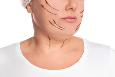 Woman with double chin ready for cosmetic surgery operation on white background, closeup