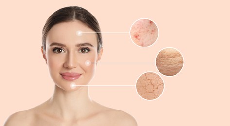 Image of Young woman with skin problem on beige background