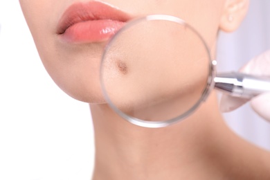 Dermatologist examining patient with magnifying glass in clinic, closeup view