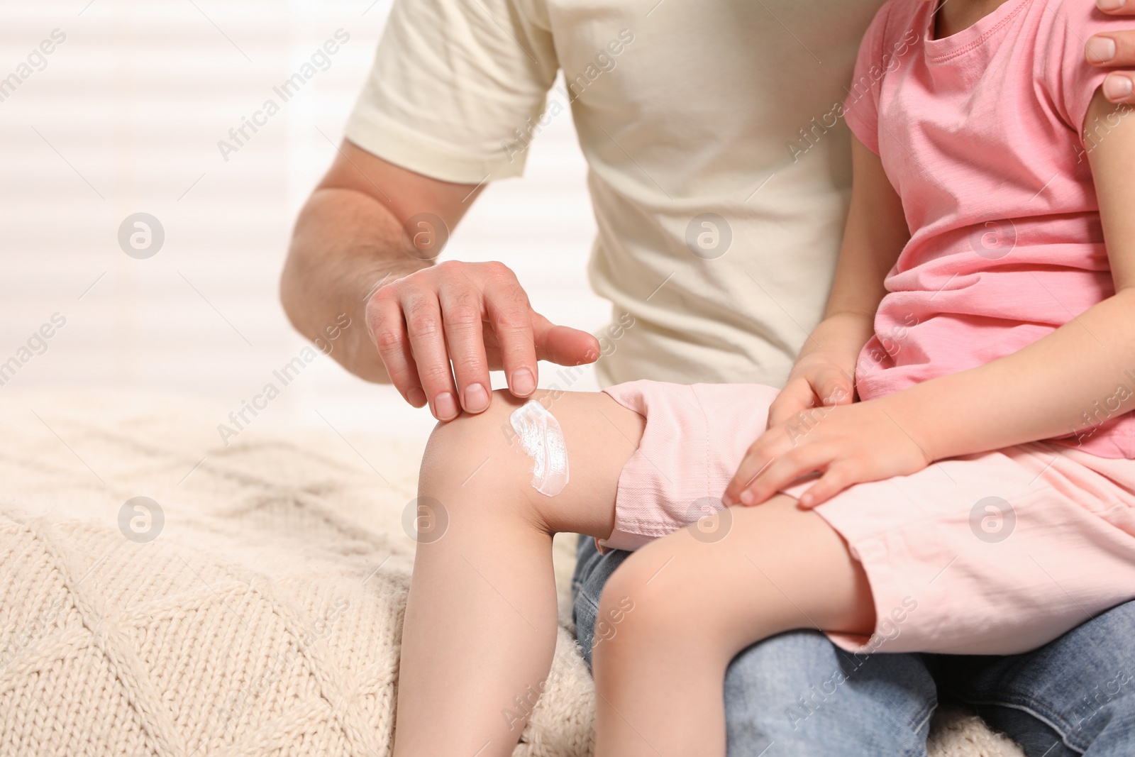 Photo of Father applying ointment onto his daughter's leg on bed, closeup