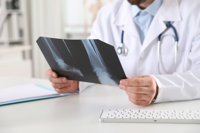 Photo of Orthopedist examining X-ray picture at desk in office, closeup