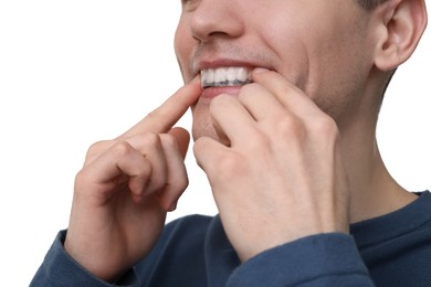 Young man applying whitening strip on his teeth against light background, closeup