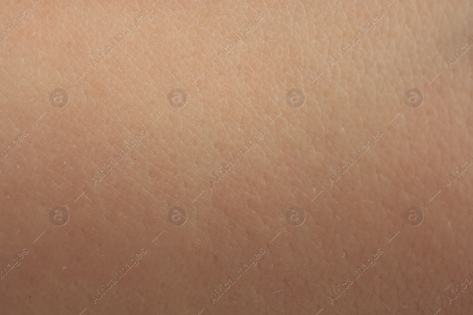 Photo of Texture of dry skin as background, macro view