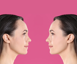 Image of Mature woman before and after cosmetic procedure on pink background 