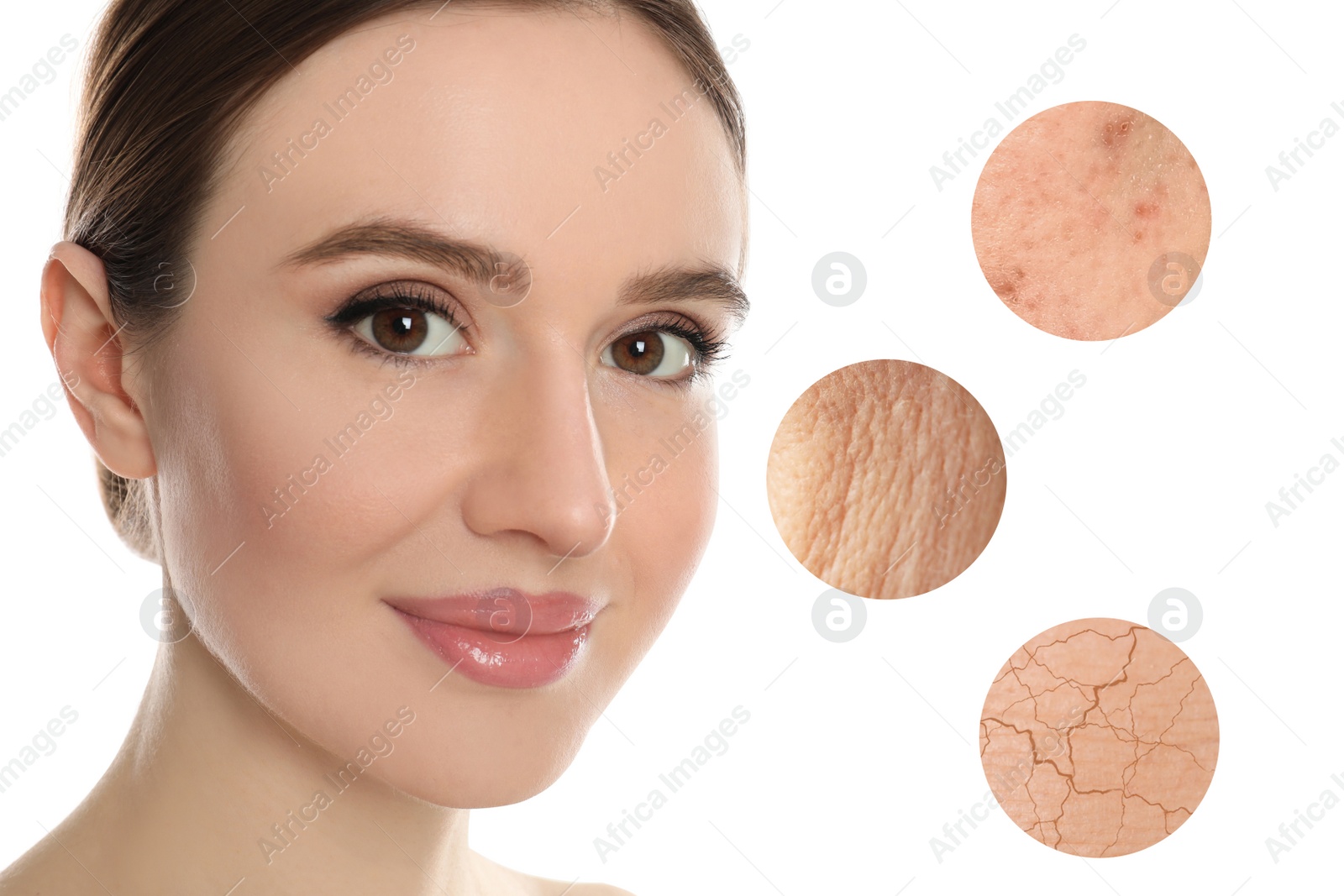 Image of Portrait of young woman with beautiful face after treatment on white background. Skin problem 