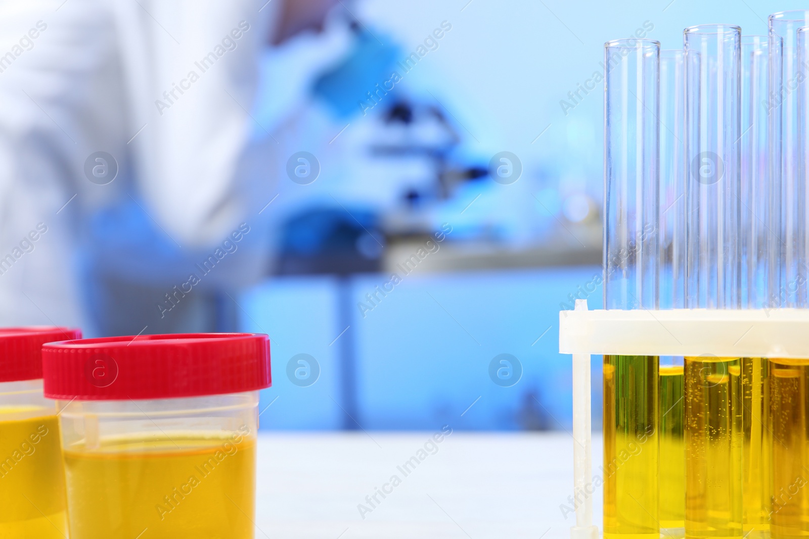 Photo of Containers with urine samples for analysis on table in laboratory