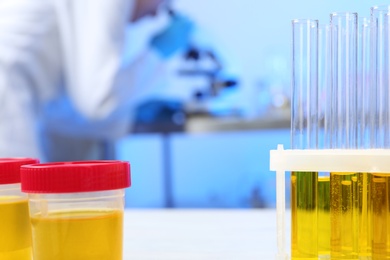 Photo of Containers with urine samples for analysis on table in laboratory